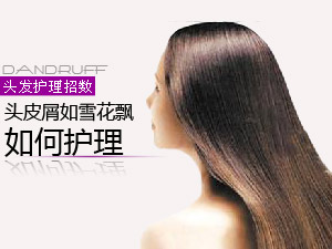 如何减少头皮屑