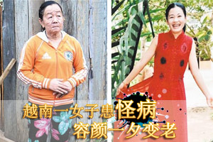 越南一女子患怪病容颜一夕变老