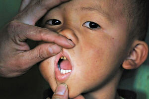 云南鹤庆村庄疑遭遇“氟污染” 三岁儿童掉牙