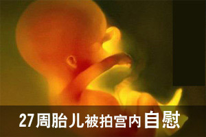 孕妇产检发现27周男胎儿宫内自慰