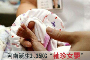 河南诞生1.35KG“袖珍女婴” 能否存活待观察