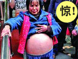 女子为治“大肚病”自行剖腹（图）
