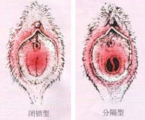 图解 最真实的<em>女人</em>阴道<em>图片</em> - 健康<em>生活</em> - 网站新