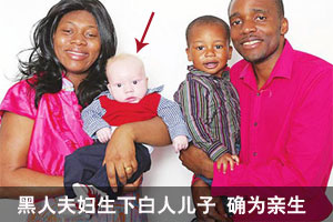 基因突变 黑人夫妇生下白人儿子