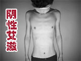 钟南山揭“阴性艾滋”谜团