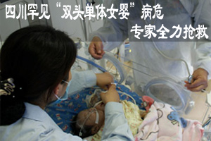 四川罕见“双头单体女婴”病危 专家全力抢救(图)