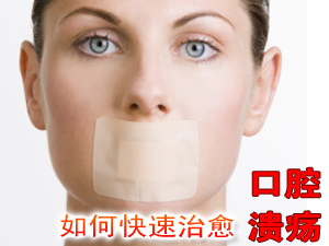 口腔溃疡怎么办