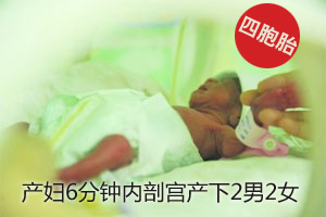 产妇6分钟内剖宫产下2男2女四胞胎
