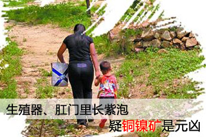 济南一村庄周边村民频得怪病 生殖器里长紫泡