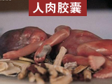 死婴制成“人肉胶囊”曝光 卫生部介入调查