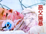 恶父用开水淋女儿续：施暴现场现人皮