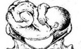 准妈最怕：胎位异常怎么生？