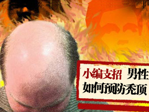 男性预防秃顶