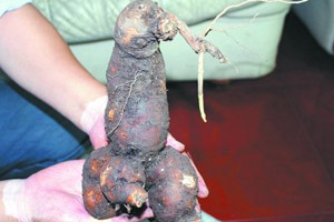 男人阴茎颜色也分等级吗？