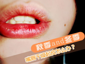 嘴唇干燥怎么办