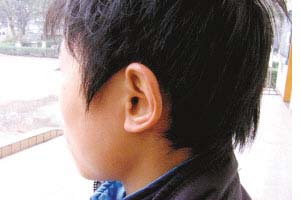 男孩被老师连扇耳光罚站左耳耳鸣