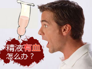 怎么精液有血