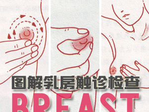 乳房触诊检查