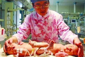 医院为连体姐妹成功实施分身手术(组图)
