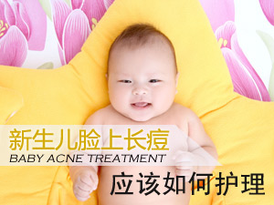 婴儿痤疮护理