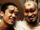 世界上最诡异的人体植入[组图]