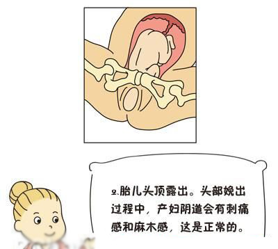详细图解:分娩子宫颈的变化_保健图库频道_医