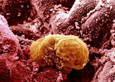 图片显示的是人类胚胎