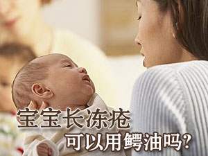 宝宝长冻疮咋办