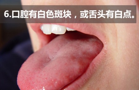 揭秘14个最迷惑人的癌症前兆 揭秘14个最迷惑人的癌症前兆