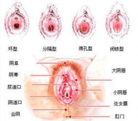 图解处女膜破裂的全过程! 图解处女膜破裂的全过程!