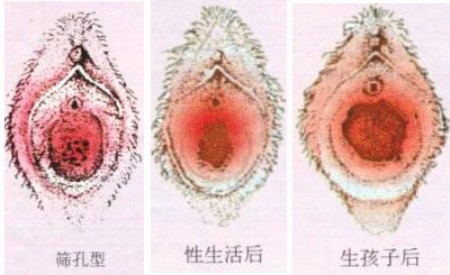 图解处女膜破裂的全过程! 图解处女膜破裂的全过程!