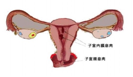 与男人有关的六种妇科病