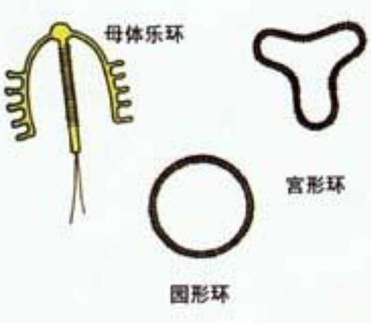 爆！女性上环全过程(多图）