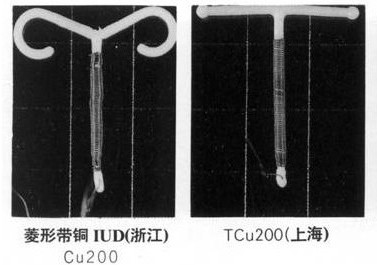 爆！女性上环全过程(多图）