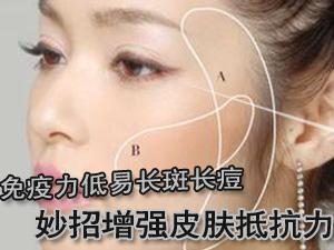 免疫力低易长痘