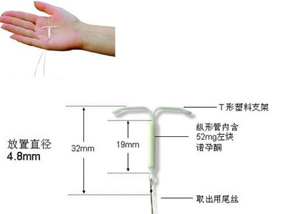 科学界发明了T形环