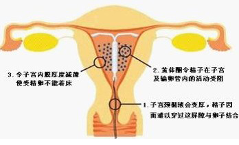 释放铜离子增加避孕的效能