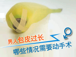 包皮手术何时做