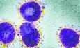 法发现首例新型冠状病毒病例 与非典属一类