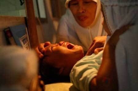 印尼少女阴部割礼手术