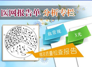 精液检查分析