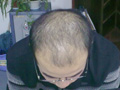 男人防脱养发味美食疗菜单！
