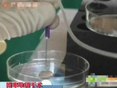 揭秘:人工授精全过程(组图)