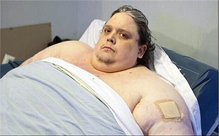 全球最胖男人死亡 十年不出家门重达888斤全球最胖男人死亡 十年不出家门重达888斤