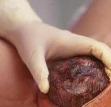 实拍产妇顺产分娩全过程实拍产妇顺产分娩全过程