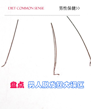 盘点男人脱发四大误区
