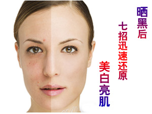 晒黑后美白方法