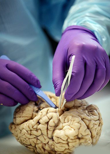 高清图解大脑解剖全过程