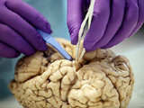 高清图解大脑解剖全过程