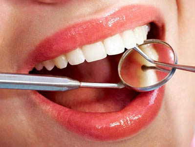 常见的牙齿美白方式有哪些